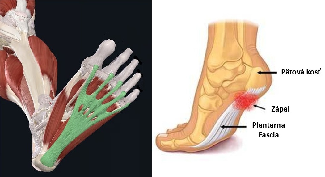 Plantárna fascia - detail